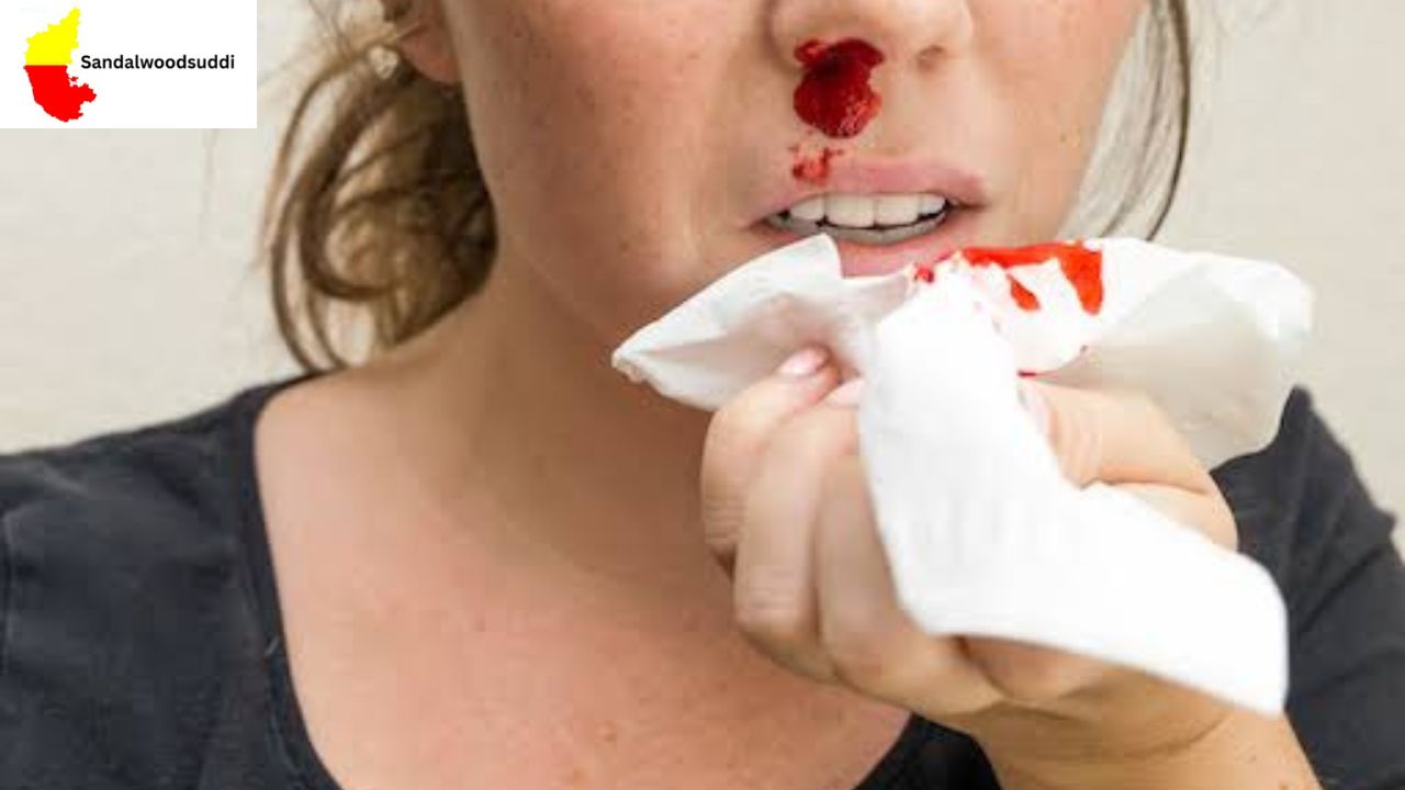 Summer Nose Bleeding